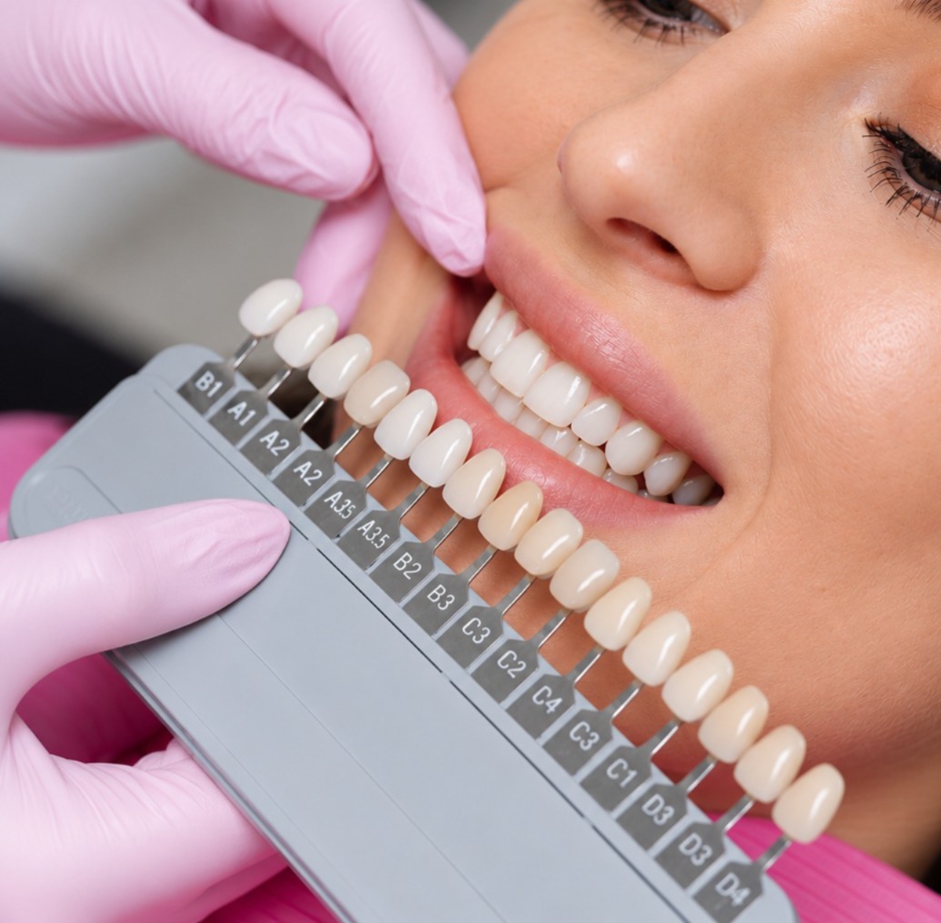 Estética dental